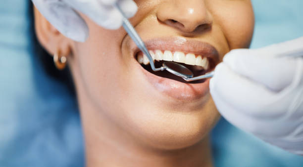 Best Emergency Dentist for Lost Fillings or Crowns in Yosemite Valley, CA