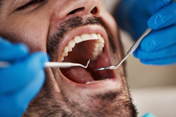 Best Mobile Emergency Dentist in Yosemite Valley, CA
